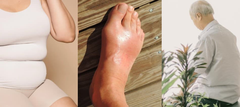 醫師揭密調理心法!中醫也能調養的十大科別 阿茲海默、減重、痛風都OK