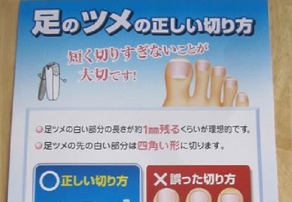 日診所曝腳指甲正確剪法!網友驚:我30年來都剪錯了…