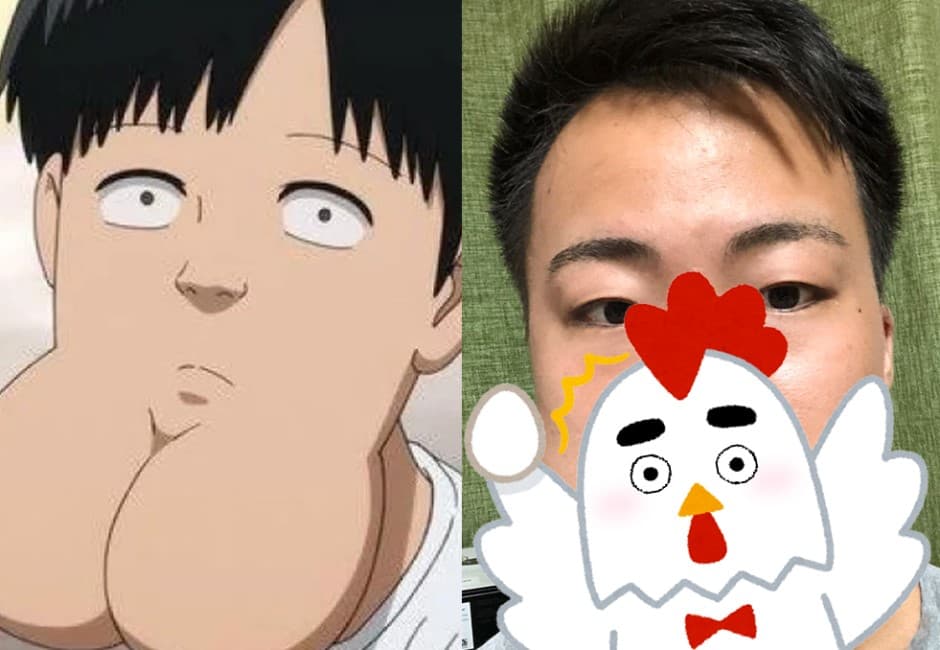 嫌麻煩一次拔4顆智齒竟長出「蛋蛋下巴」 網友傻眼笑歪